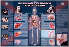 Электрифицированный стенд "Вредные привычки: алкоголизм" - fgospostavki.ru - Обнинск