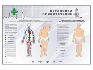 Электрифицированный стенд "Остановка кровотечения" - fgospostavki.ru - Обнинск