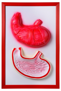 Барельефная модель "Желудок" - fgospostavki.ru - Обнинск