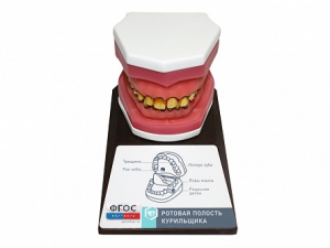 Демонстрационная модель "Ротовая полость курильщика" - fgospostavki.ru - Обнинск