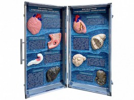 Учебно-демонстрационный кейс "Последствия употребления алкоголя и наркотиков" - fgospostavki.ru - Обнинск