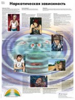 Плакат "Наркотическая зависимость" ламинированный - fgospostavki.ru - Обнинск