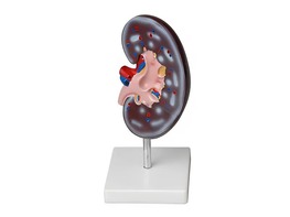 Модель почки в разрезе - fgospostavki.ru - Обнинск