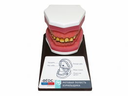 Демонстрационная модель "Ротовая полость курильщика" - fgospostavki.ru - Обнинск